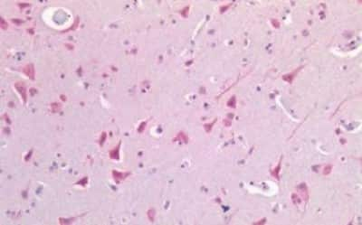 Immunohistochemistry-Paraffin: USP19 Antibody [NBP3-14512]